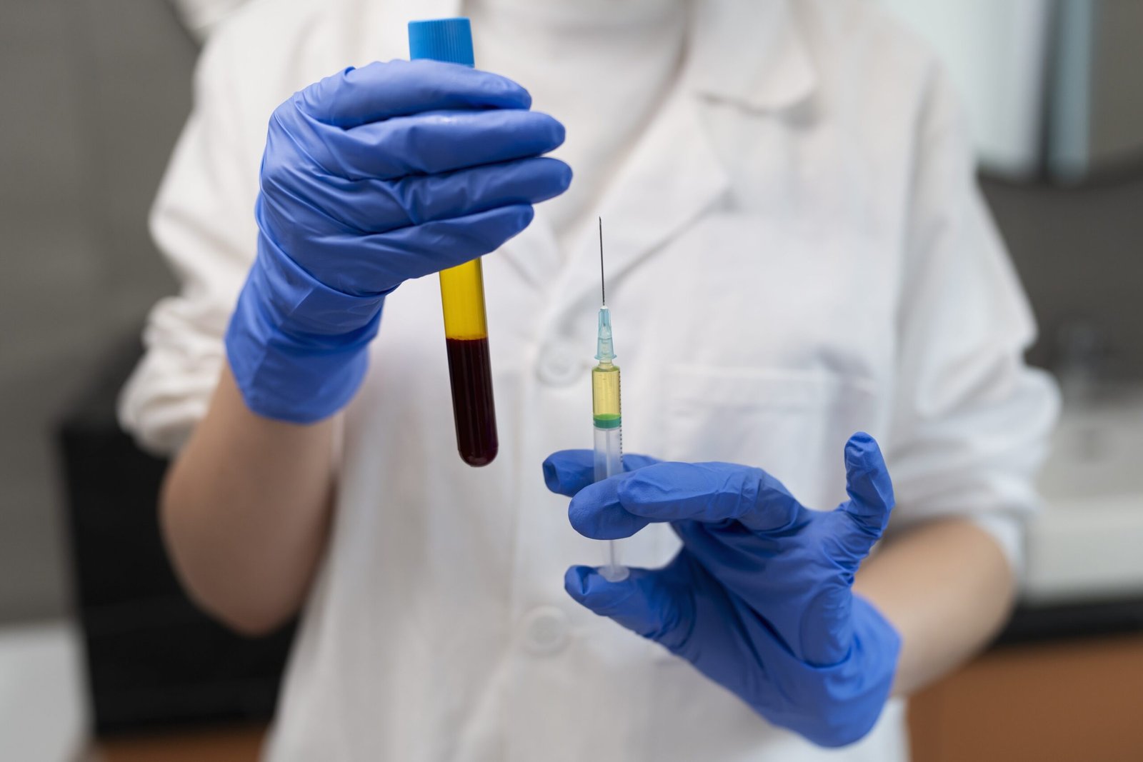 Profesional de salud con guantes sosteniendo jeringa y tubo con muestra para plasma rico en plaquetas (PRP)